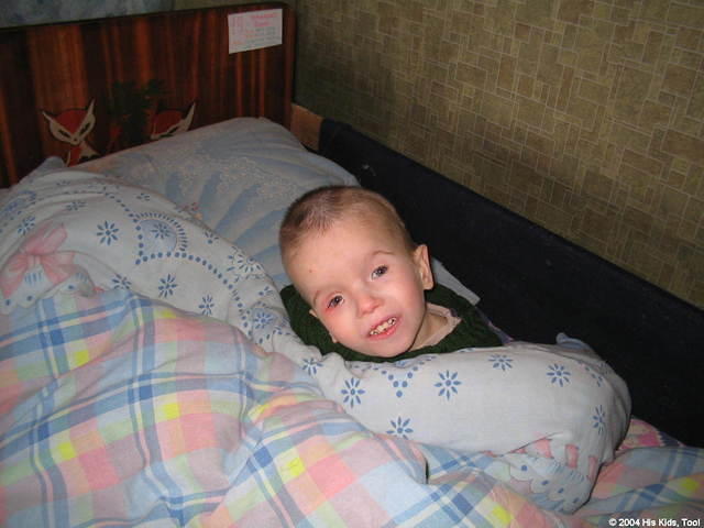 This little boy has an eye infection.