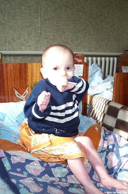 This child with a special need,  is in need of medical attention.