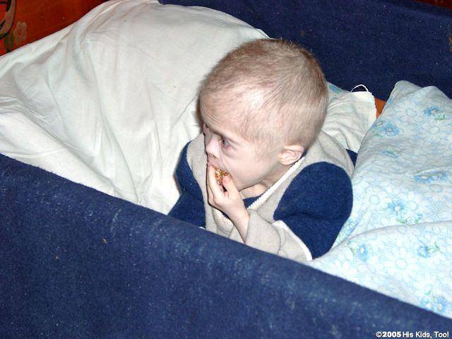 Many of the children are extremely frail.