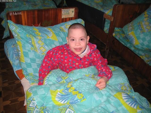 Despite some very physical problems, this boy is cheerful.