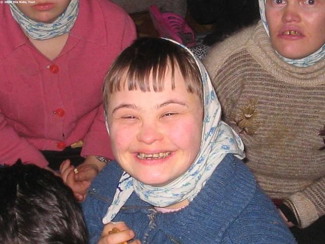 This previous young lady will live her for her entire life.