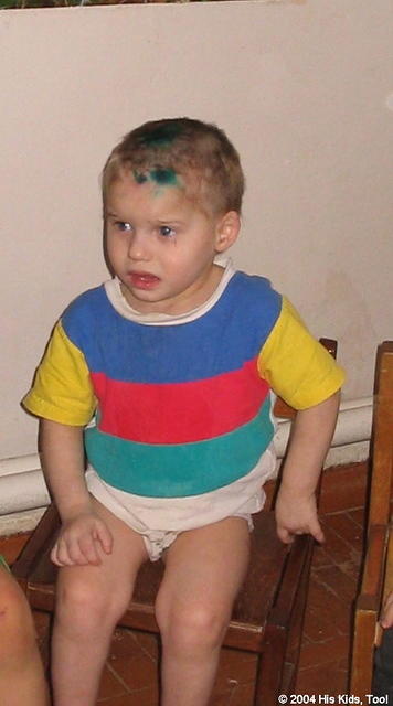 This little one has medicine covering him.