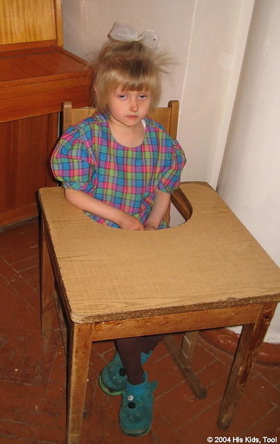 This young girl is quite delayed.