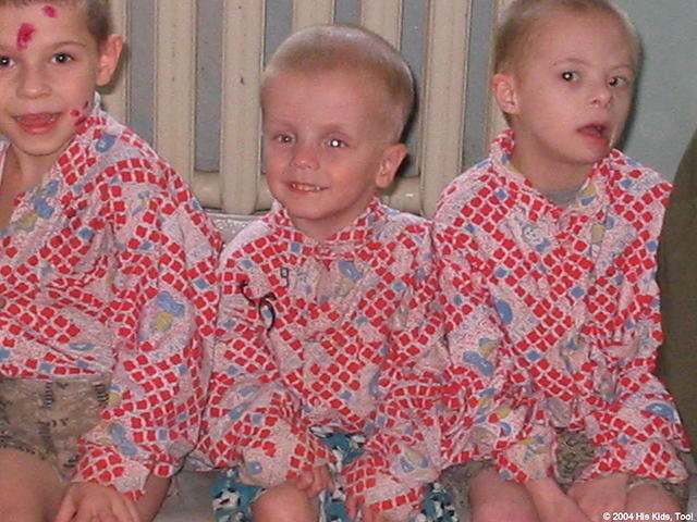 To look at these children, one can't 'see' a thing, but  many are mentally challenged.