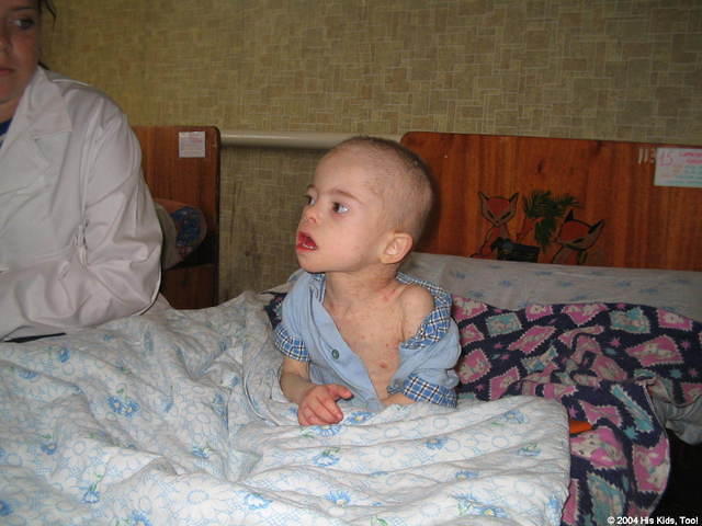 This little boy with Down's Syndrome, had some other physical medical conditions.  We left some medicine to hopefully help.