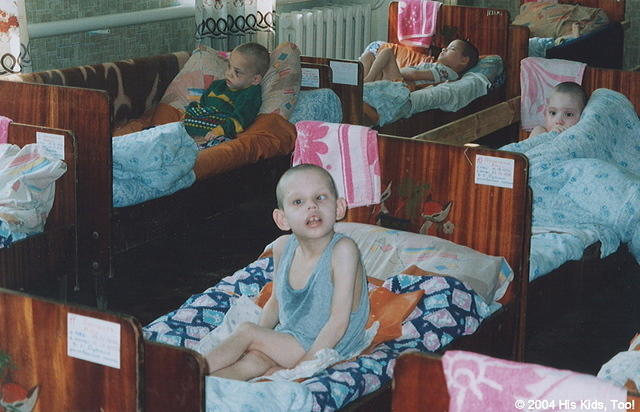This 11 yr. old boy sits in his own 'waste', diapers were provided on our next visit.