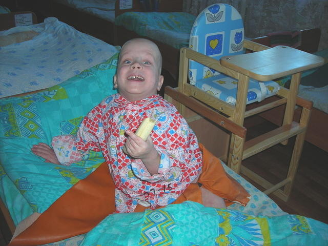 It is always a joy to see this child.  Despite his physical problems he is always happy and conversational.