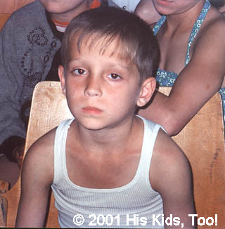 This young boy (Oleg) seems very sad at his living situation.