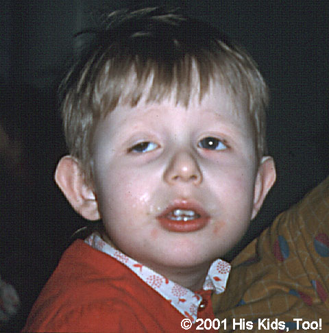 Please visit "Adopted Children" to see what a huge difference love and medical care can make to a child.