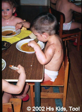 With your donations, His Kids, Too! Provided medical care for this boy