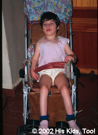 This child still awaits a wheelchair