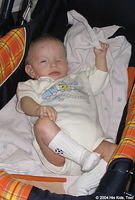 This baby is missing an eye, and ear.