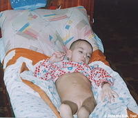 This child lies in wait to be attended to, many of children lie in this condition.  For these children there is 1 worker for 25-