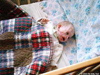 This little boy, was severely burned in an orphan facility at just 3 months old.  He will start having surgeries soon to help co