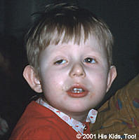 Please visit "Adopted Children" to see what a huge difference love and medical care can make to a child.