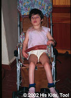 This child still awaits a wheelchair