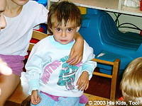 This child was very frail.